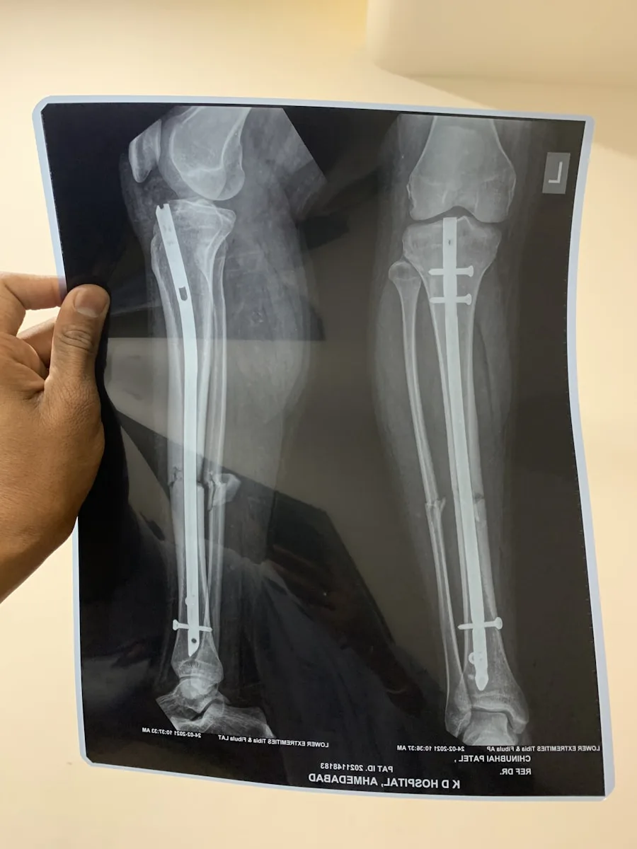 Orthopedics and Joint Replacement