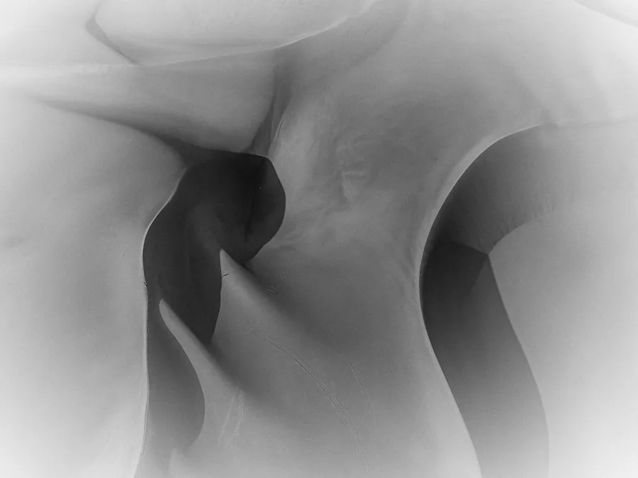Orthopedics and Joint Replacement